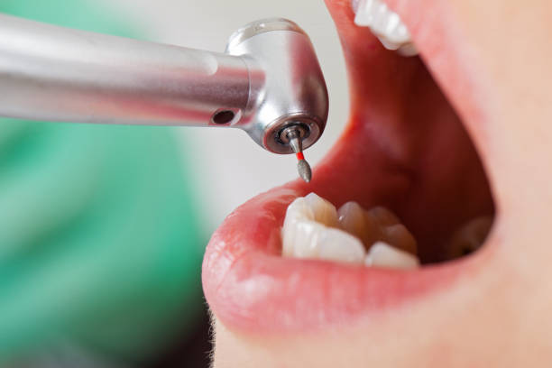 Best Broken or Cracked Tooth Emergency Dentist in Sewell, NJ